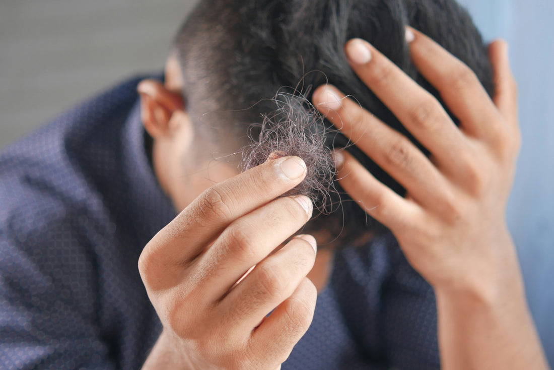 Can Hair Loss Be Reversed? Exploring Natural and Medical Solutions